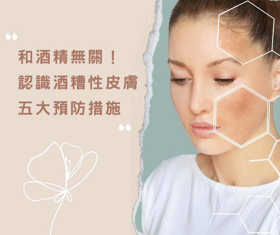 酒糟性皮膚炎是什麼？與飲酒有關係嗎？五招預防酒糟肌避免惡化