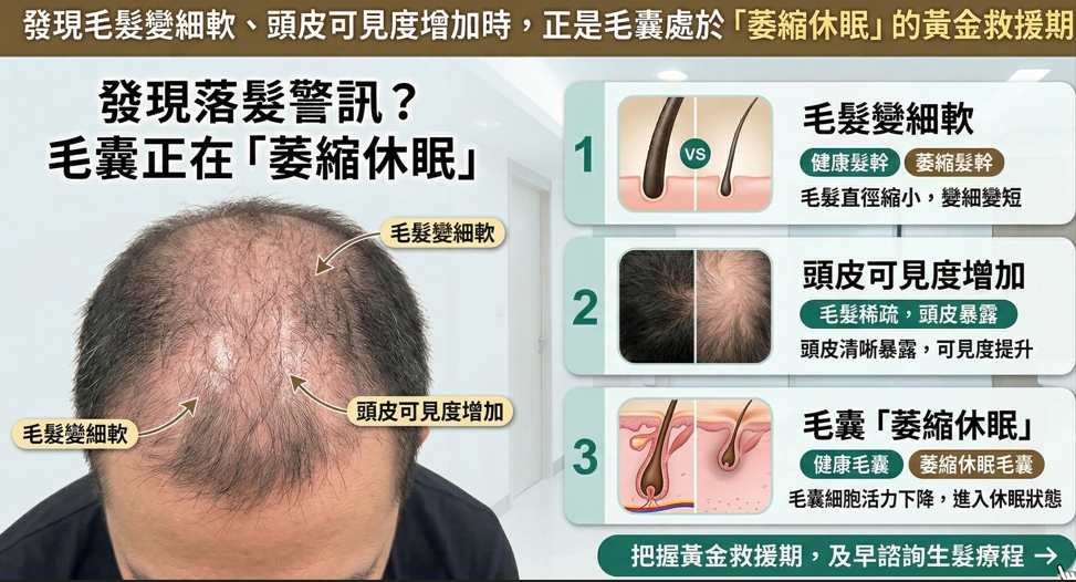 【2026生髮費用評估：不想植髮有救嗎？醫學認證「二次離心PRP」維持多久與真實心得總整理】