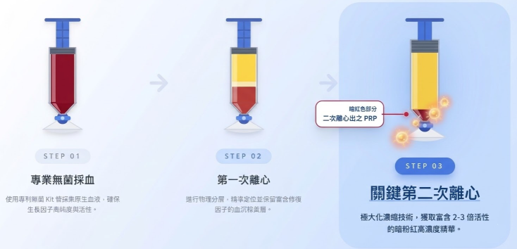 二次離心 PRP 技術