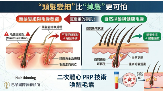 揭開毛囊萎縮的無聲危機