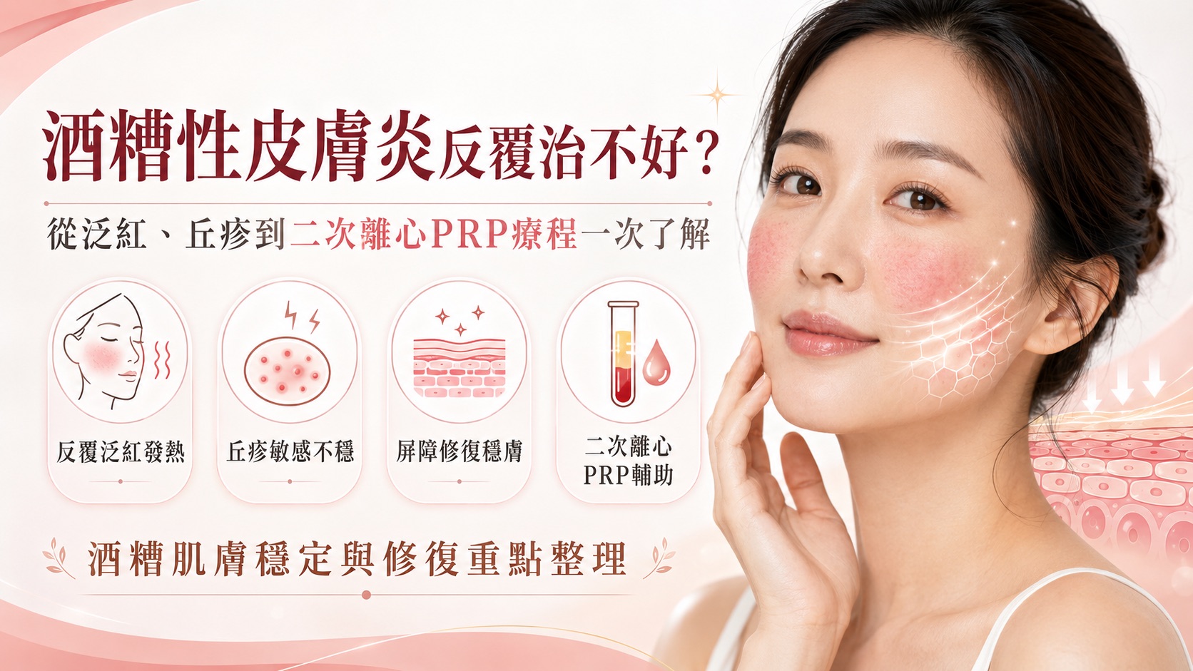 酒糟性皮膚炎反覆治不好?從泛紅、丘疹到二次離心PRP療程一次了解